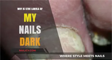 Dark Lunula on Nails: Causes, Concerns, and When to Seek Help