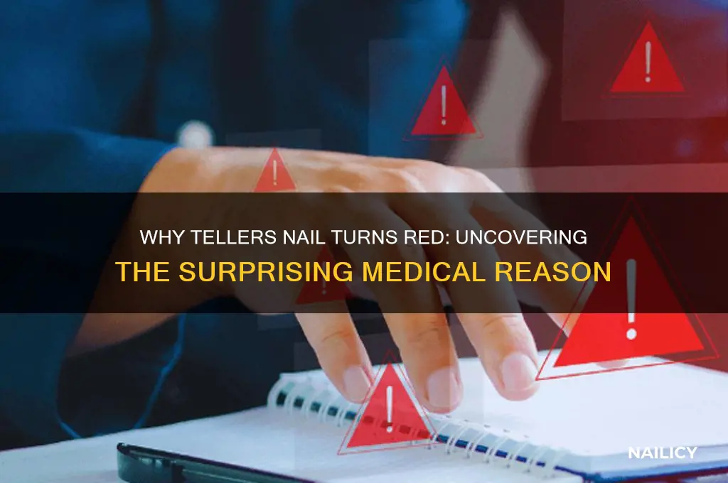 why is tellers nail red