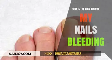 Why Does the Skin Around My Nails Bleed? Causes & Solutions