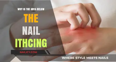 Itchy Under Nail? Causes and Remedies Explained
