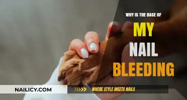 Why Is the Base of My Nail Bleeding? Causes and Solutions