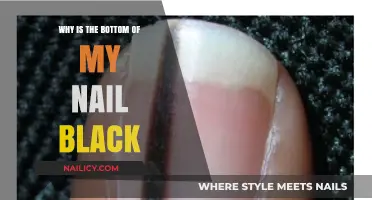Black Nail Bed: Causes, Concerns, and When to Seek Help