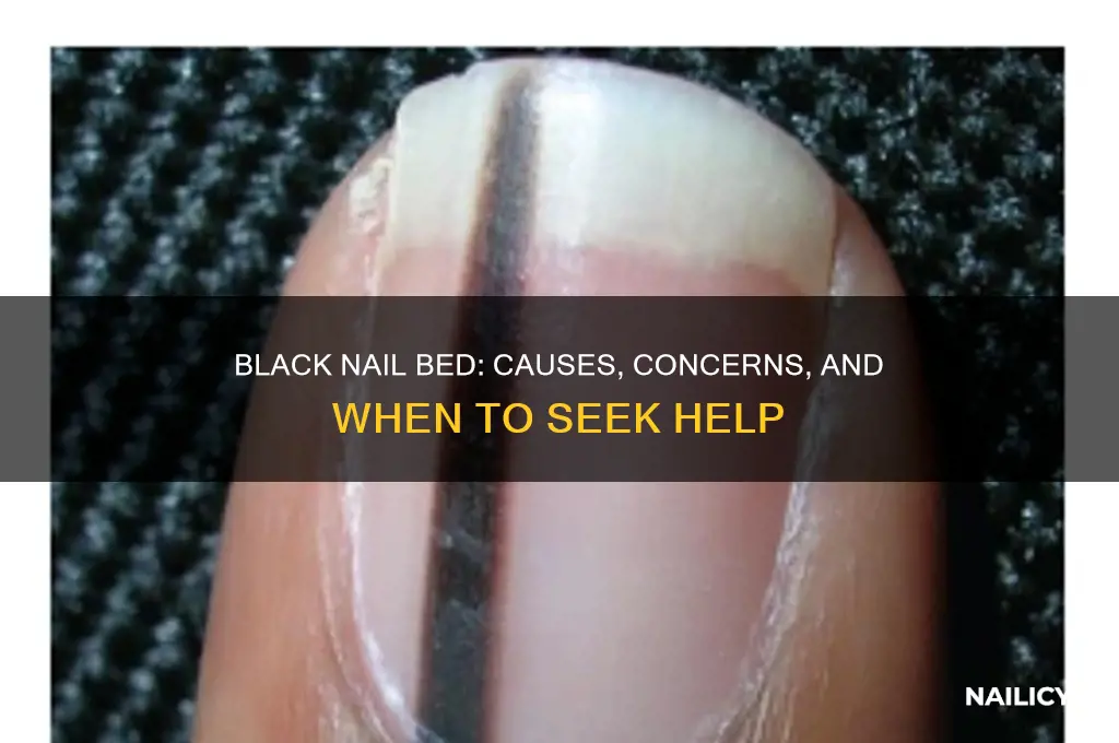 why is the bottom of my nail black