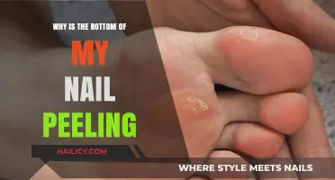 Why Is the Bottom of My Nail Peeling? Causes and Solutions