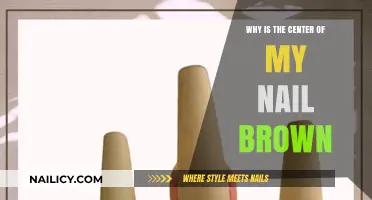 Why Is the Center of My Nail Brown? Causes and Solutions