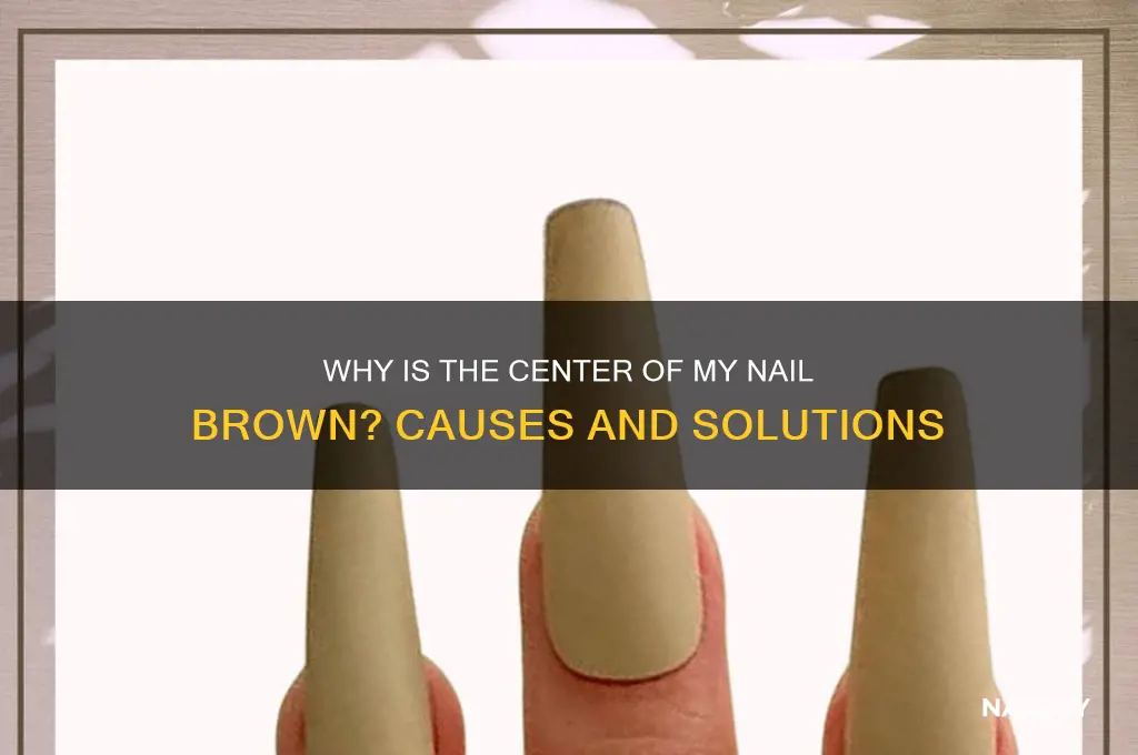 why is the center of my nail brown