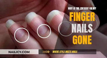 Vanishing Crescent: Understanding Nail Changes and Their Causes