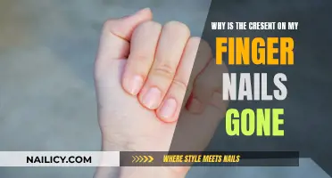The Mystery of the Disappearing Crescent Moon on Fingernails