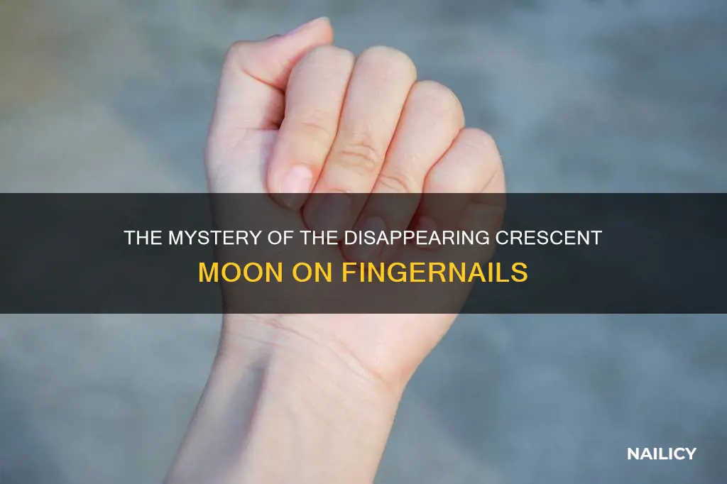 why is the cresent on my finger nails gone