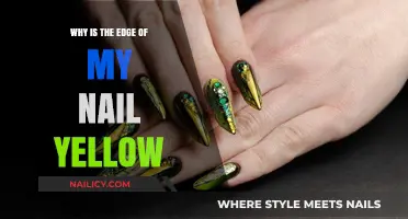 Yellow Nail Edges: Causes, Concerns, and Effective Solutions Explained