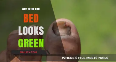 Green Nail Beds: Causes, Concerns, and When to Seek Help