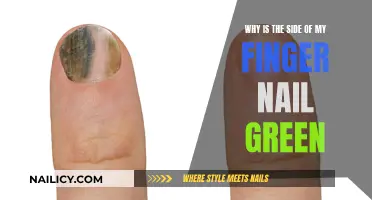 The Mystery of Green Nails: What Does It Mean?