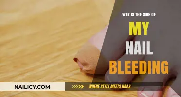 Why Is the Side of My Nail Bleeding? Causes and Solutions