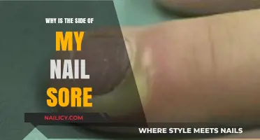 Why Does the Side of My Nail Hurt? Causes and Remedies