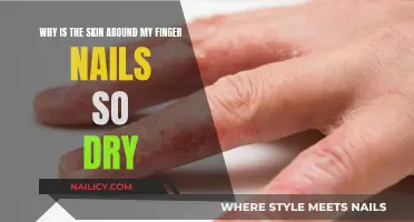 How to Treat Dry Skin Around Nails