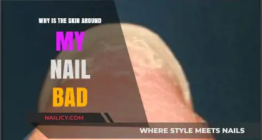 Why Your Nail Skin Looks Bad: Causes and Solutions