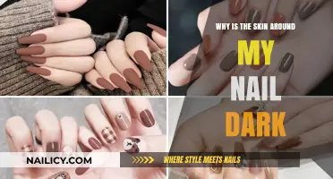 Dark Skin Around Nails: Causes, Concerns, and Solutions Explained