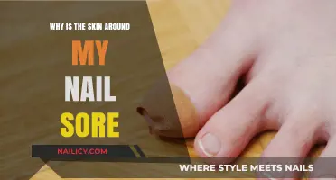 Sore Skin Around Nails: Causes, Remedies, and Prevention Tips