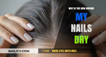 Dry Skin Around Nails: Causes, Remedies, and Prevention Tips