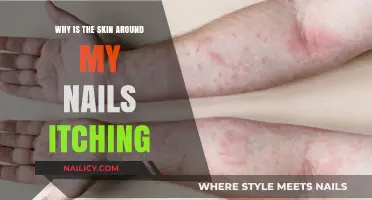Itchy Skin Around Nails: Causes, Remedies, and When to Worry