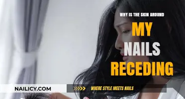 Receding Skin Around Nails: Causes, Concerns, and Solutions Explained