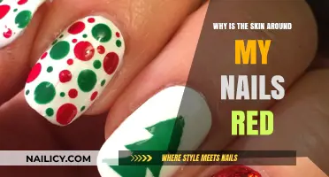Red Skin Around Nails: Causes, Concerns, and Effective Solutions