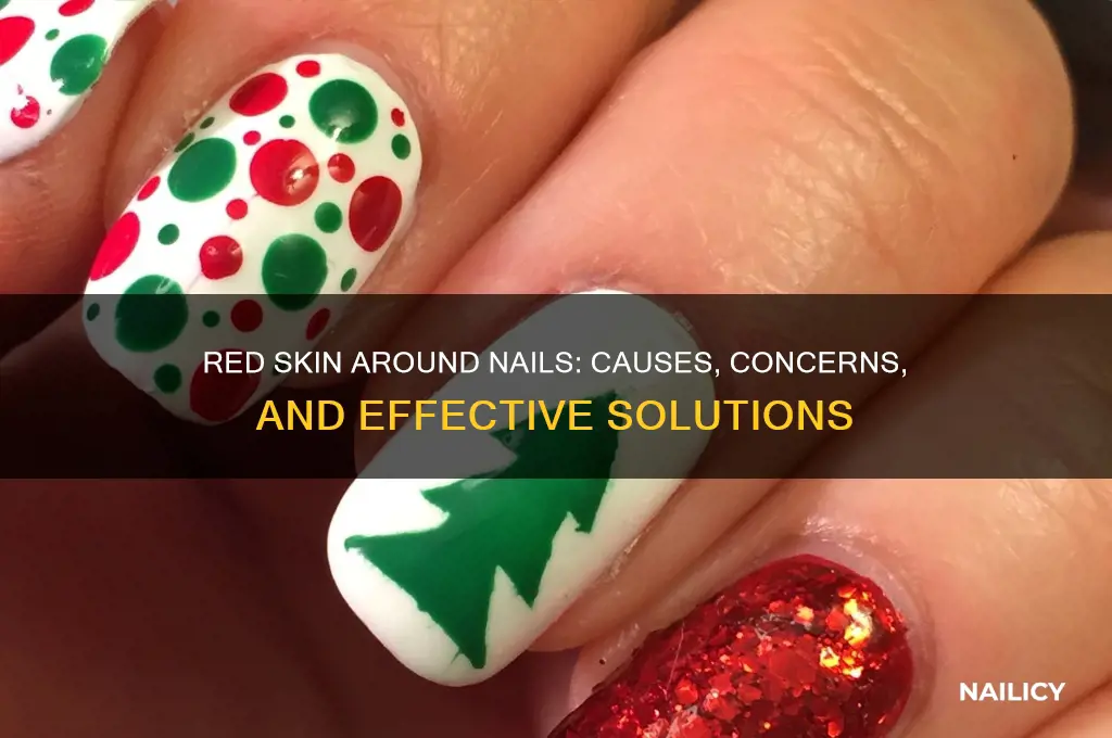 why is the skin around my nails red