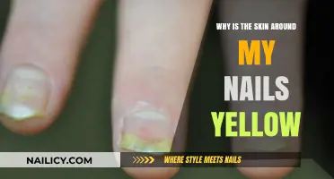 Yellow Skin Around Nails: Causes, Concerns, and Solutions Explained