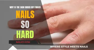 Hard Skin Under Nails: What's the Cause?