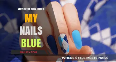 Blue Skin Under Nails: Causes, Concerns, and When to Seek Help