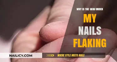 Flaky Skin Under Nails: Causes, Remedies, and Prevention Tips