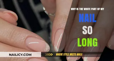 The Mystery of Long White Nail Beds