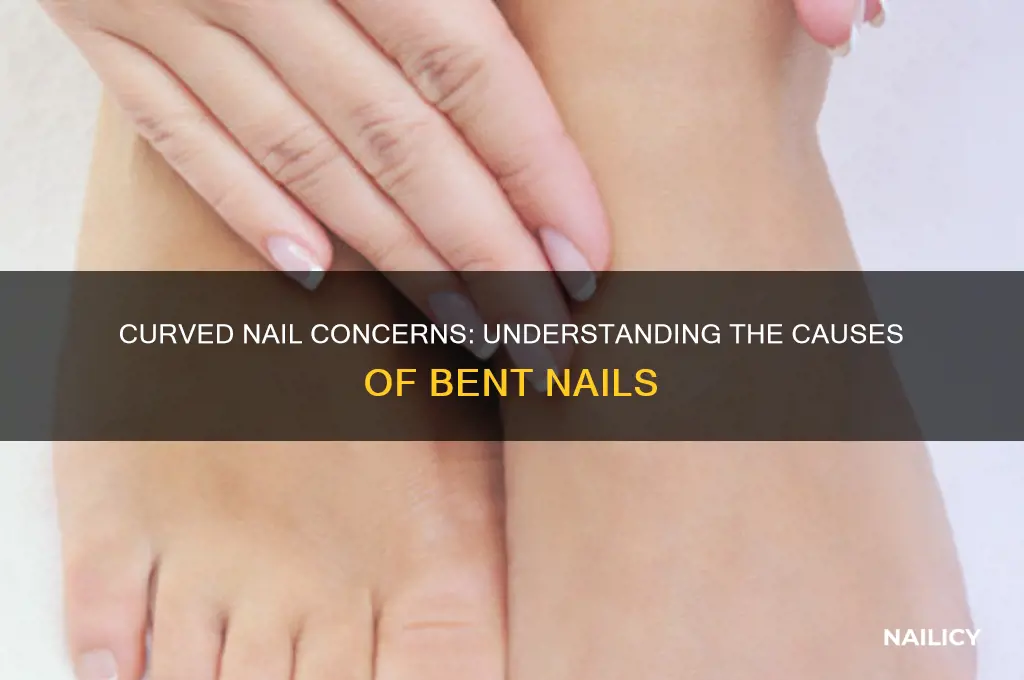 why is there a bend in my nail