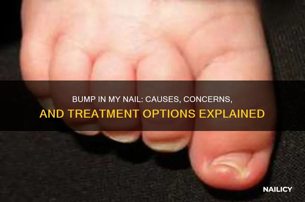 why is there a bump in my nail