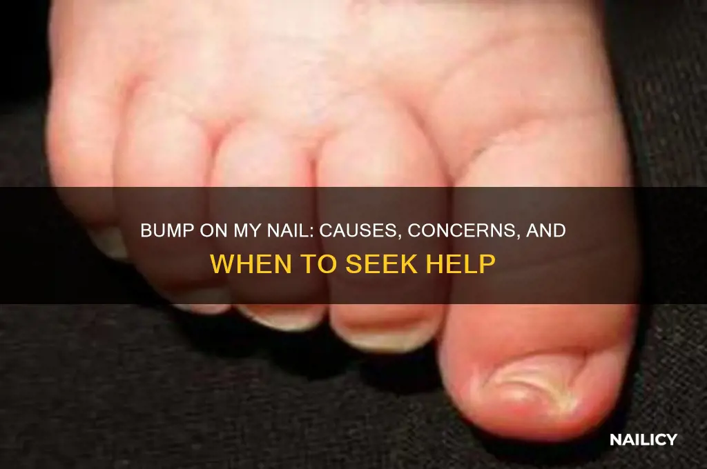 why is there a bump on my nail