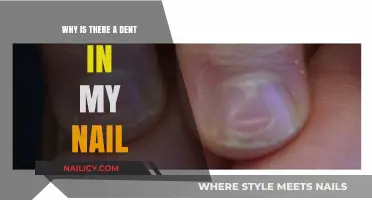 Why Is There a Dent in My Nail? Causes and Concerns