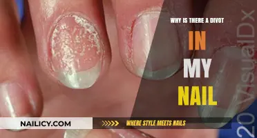 Divot in Your Nail? Causes and Solutions Explained