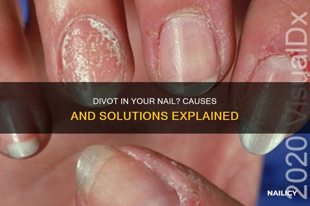 why is there a divot in my nail