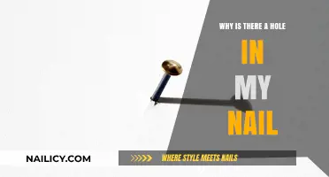 Why Is There a Hole in My Nail? Causes and Solutions