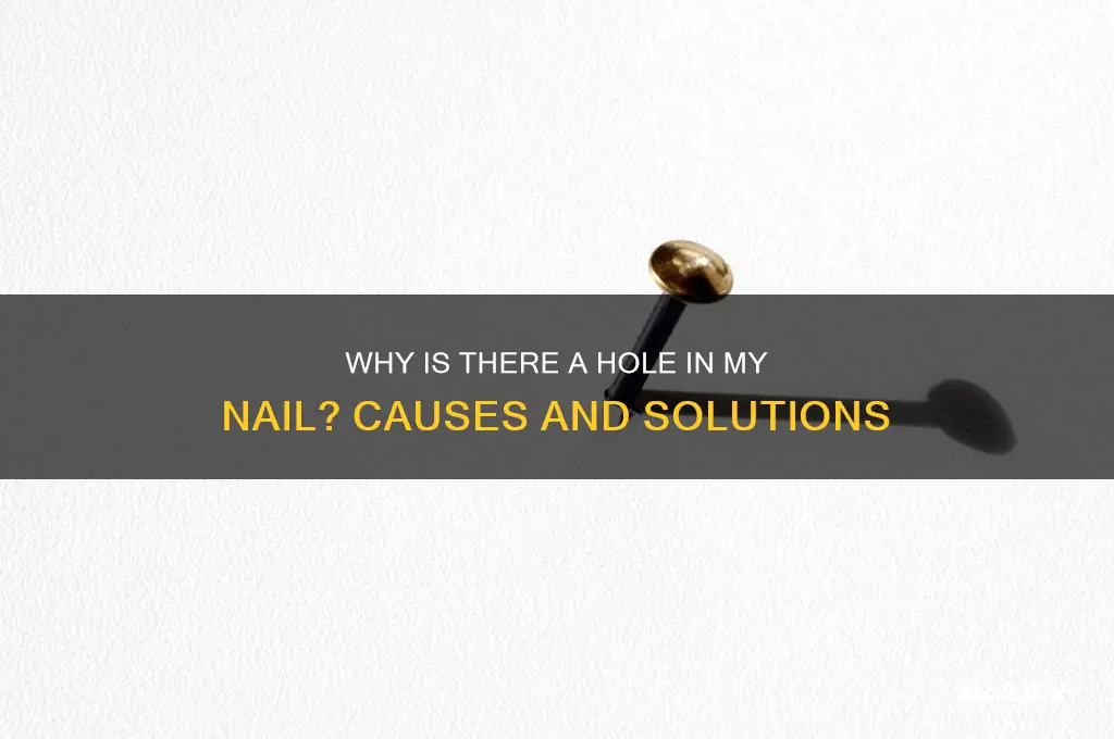 why is there a hole in my nail