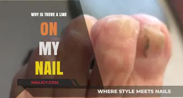 Why Is There a Line on My Nail? Causes and Concerns