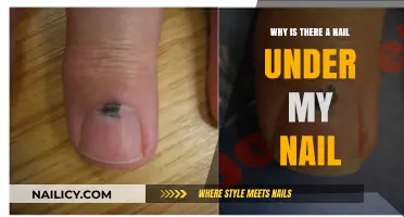 Nail Under Nail: Causes, Symptoms, and Effective Treatment Options