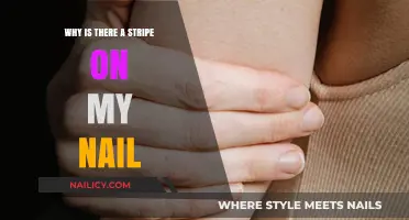 Why Is There a Stripe on My Nail? Causes and Concerns