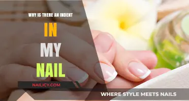 Why Do I Have an Indent in My Nail? Causes Explained