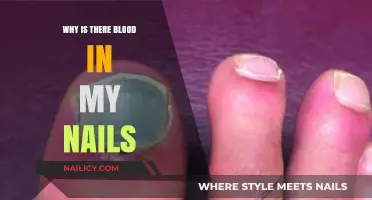 Blood Under Nails: Causes, Concerns, and When to Seek Help