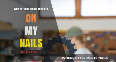 Circular Dents on Nails: Causes, Concerns, and Solutions Explained