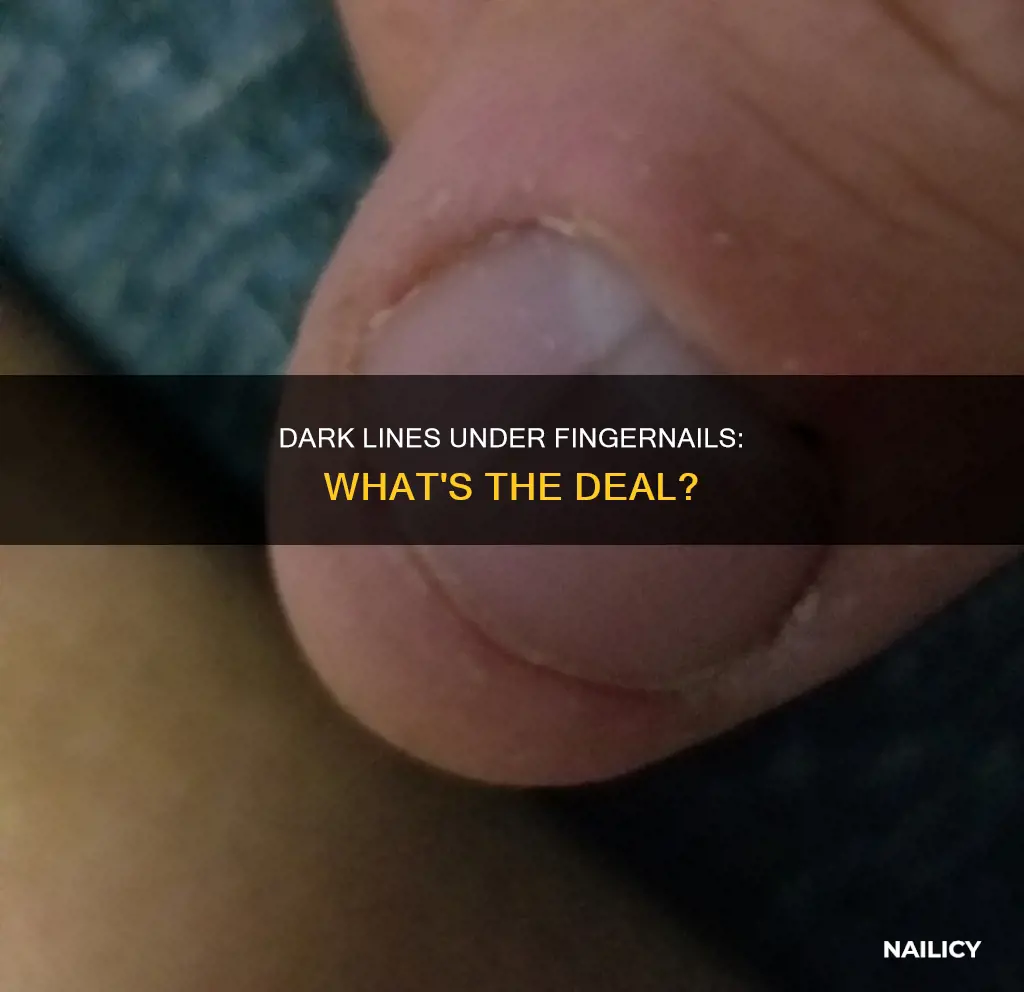 why is there dark lines under my finger nails