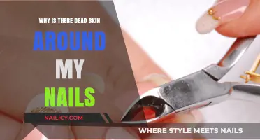 Dead Skin Around Nails: Causes, Prevention, and Effective Solutions
