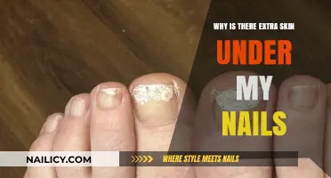 Understanding the Causes of Excess Skin Under Your Nails