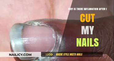 Nail Cutting: Inflammation and How to Avoid It
